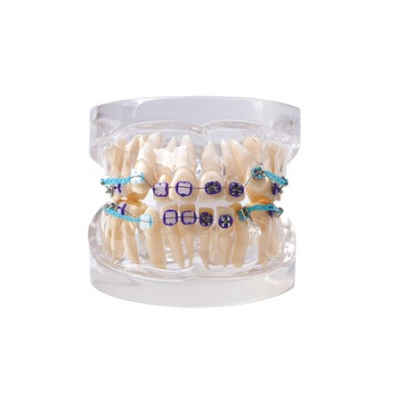 Standard Dental Model with Semi Metal and Semi Ceramic